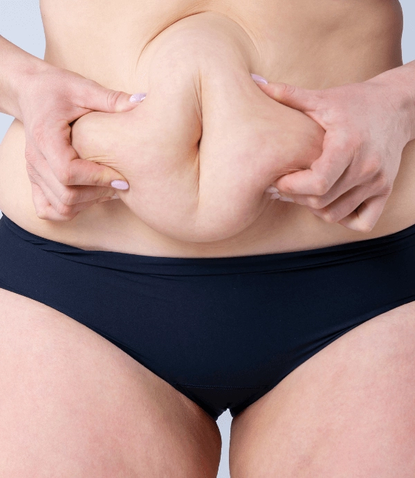 Lösungen mit Mommy Makeover